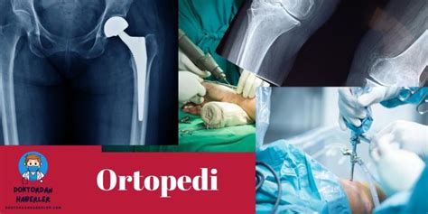 ortopedi doktoru hangi hastalıklara bakar